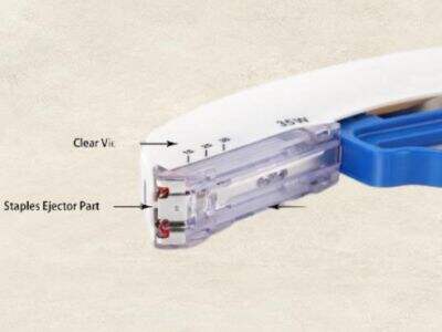 The Role of EUS Biopsy Needles in Accurate Diagnoses