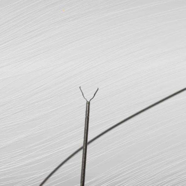 바이트 블록 수술 후 기대할 점