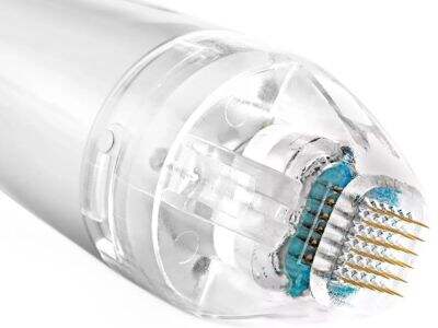 Области на третман со фракциски RF: Кои делови од телото најмногу имаат корист?