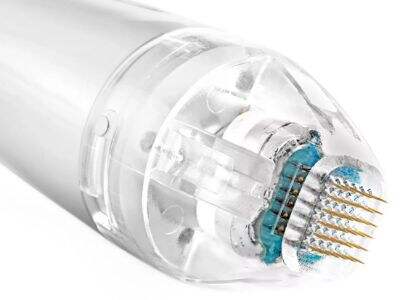 Vivace Shenb Reviews: What Aesthetic Professionals Say About This Device