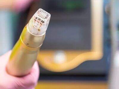 Secret RF at-Home Use: Is It Safe for Beginners Without Professional Training?