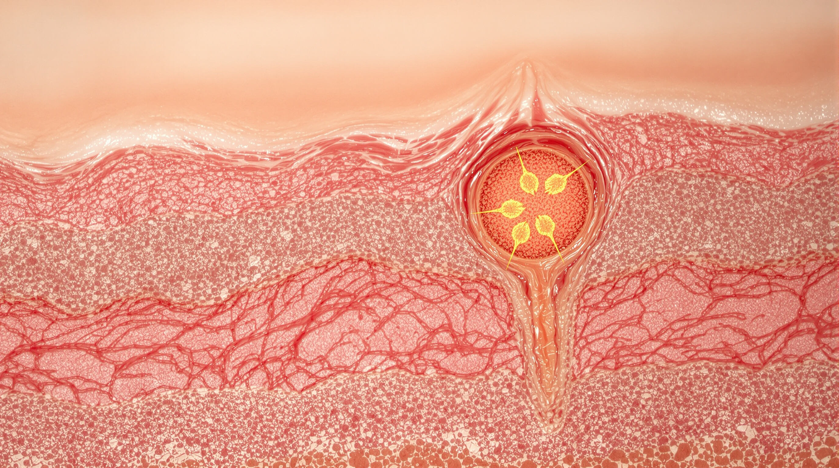 Photorealistic image of regenerating skin layers with active fibroblasts supporting growth