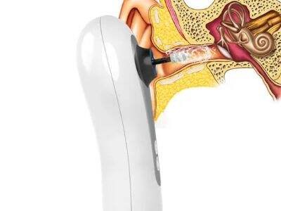 Ear Dryers for People with Hearing Aids: Keeping Your Ears Dry and Comfortable