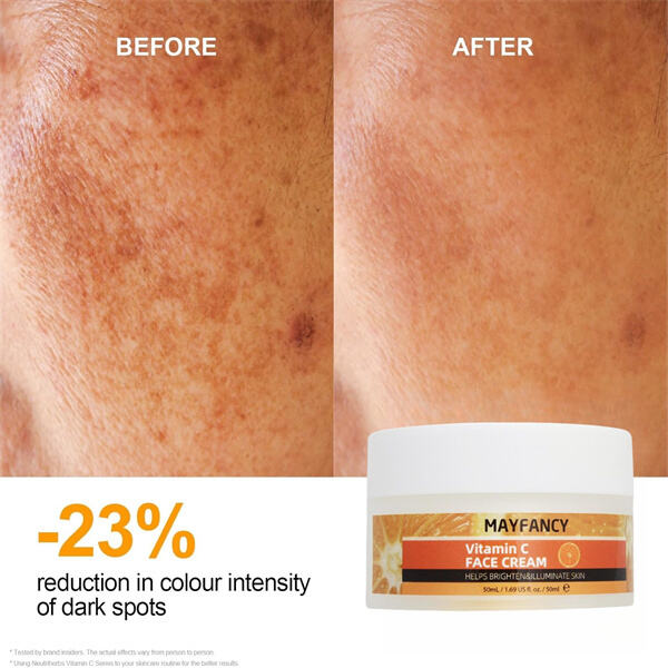 Achieve a Youthful, Healthy Glow with Men's Top Face Moisturizers