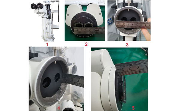 The Role of Slit Lamp Systems in Daily Ophthalmic Diagnosis
