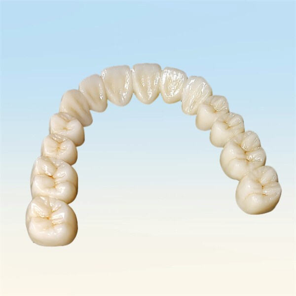 El papel de los hornos de porcelana dental en la obtención de restauraciones con apariencia natural