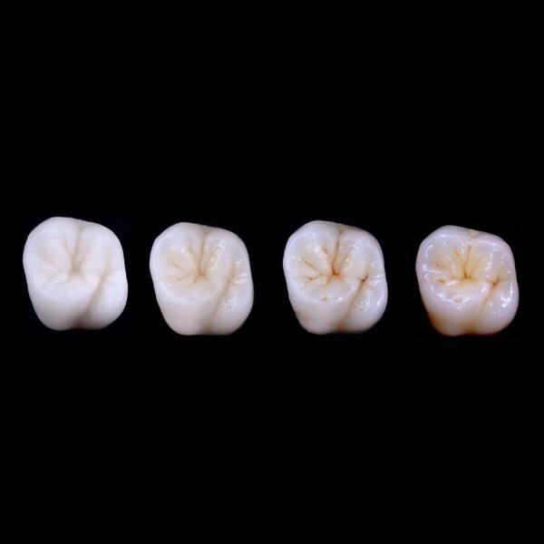 Superior aesthetics for natural-looking and aesthetically pleasing results