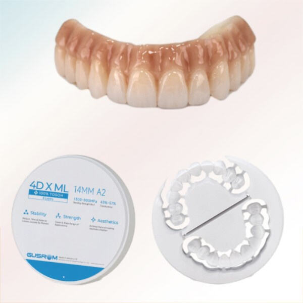 Exploring the Benefits of Zirconia Ceramic Inlays and Onlays