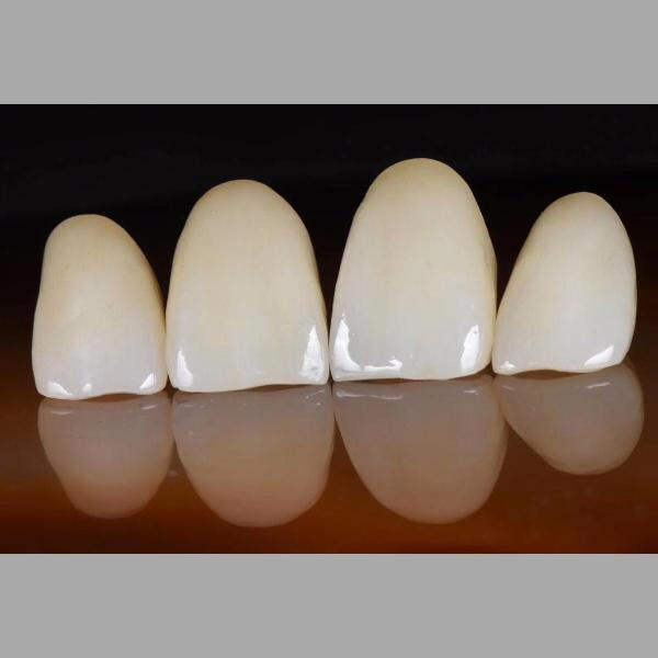 How to Maximize Profit Margins with Wholesale Glass Ceramics?