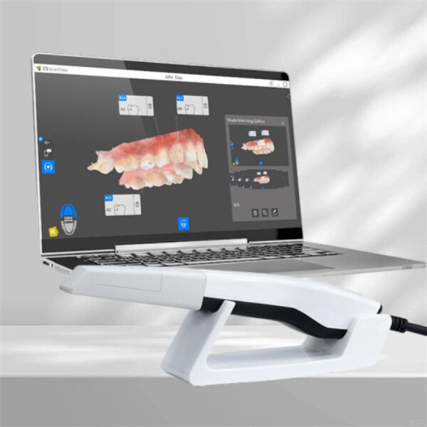 İntraoral Skanerlərin Dentallığa Necə İnqilab Etməsi
