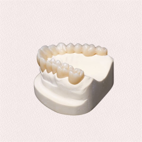 La importancia de la calidad de los hornos de porcelana