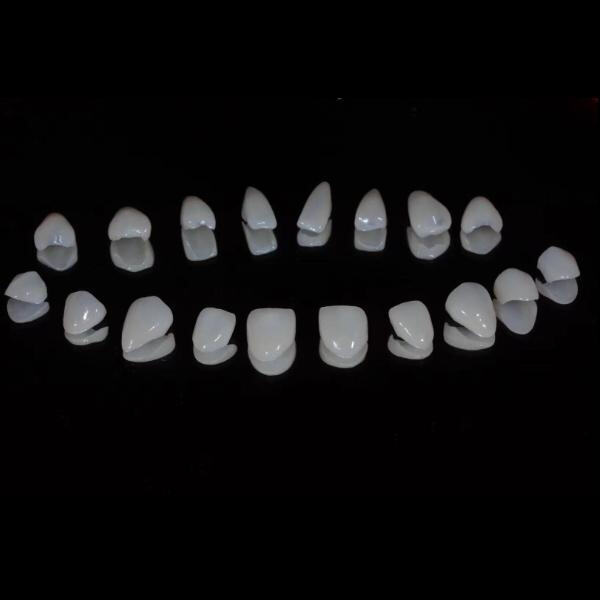 What Makes Dental Glass Ceramics the Preferred Choice for Dentists?