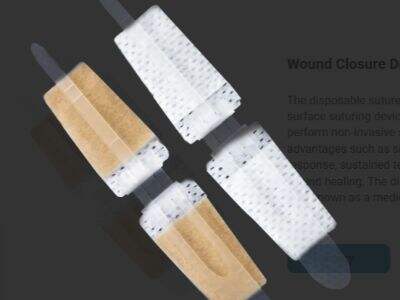 Kiedy należy stosować paski zszywające zamiast szwów?