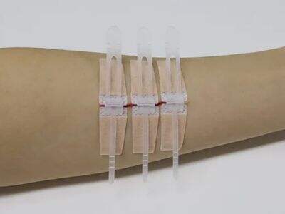 Suture Strips Innovation Trends for Medical Buyers