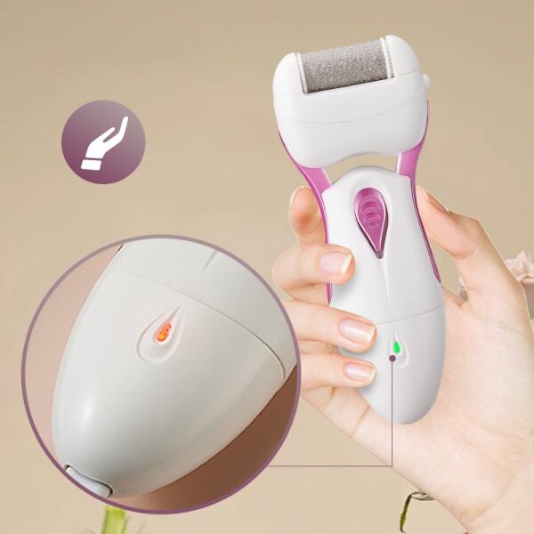 Common issues with calluses and how to address them