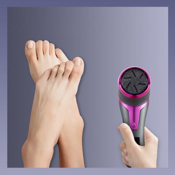 Say Goodbye to Calluses with Our Professional Callus Remover