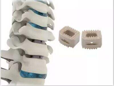 Types of Cervical Cages Used in Spine Surgery