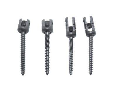 Why Ilizarov External Fixator Is Preferred for Limb Deformity Correction