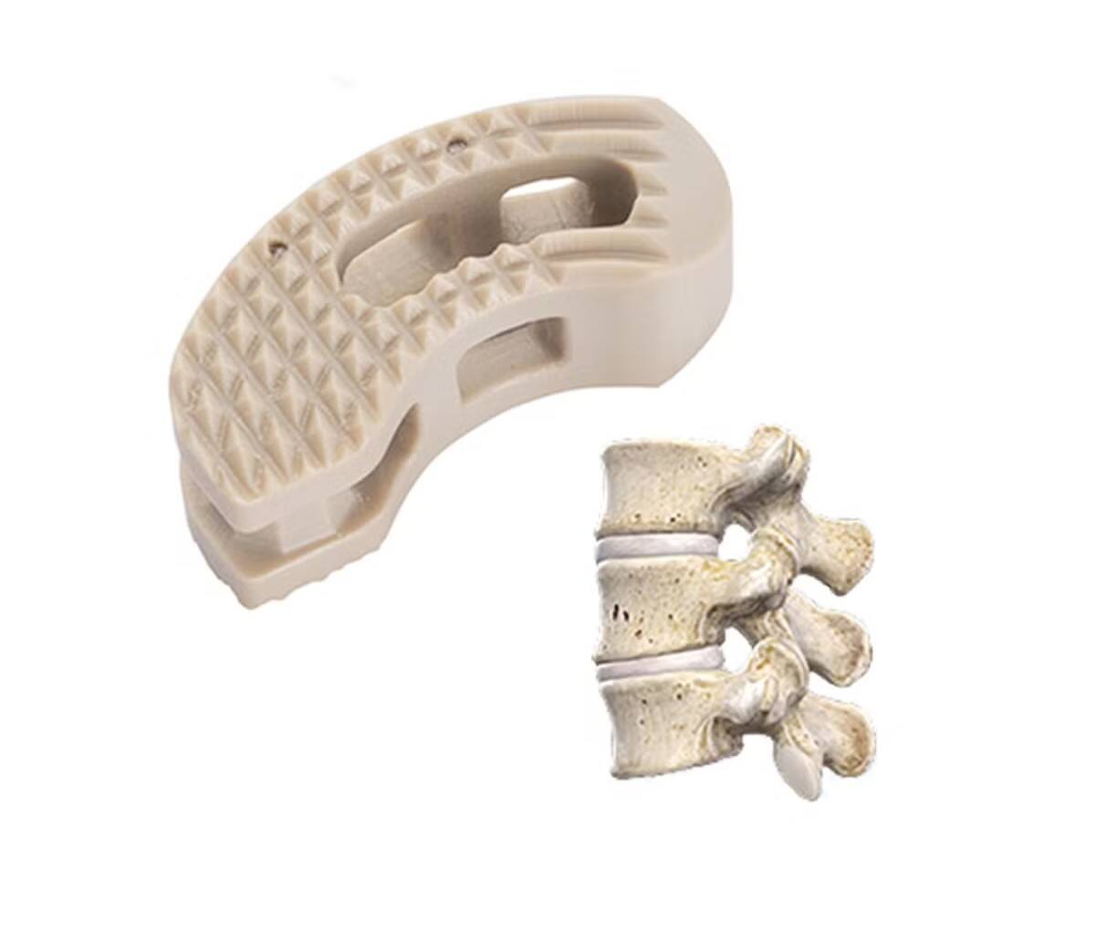 Orthopedic-Implant-Spinal-System-Peek-Cervical-Cage-Plif-Tilf-Olif-Spinal-Cage.jpg