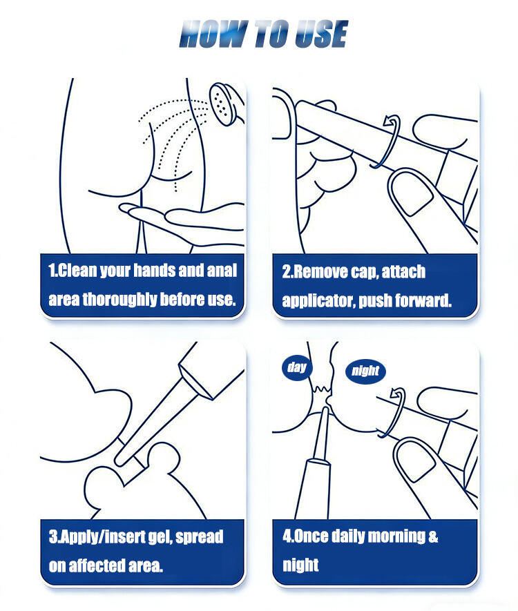 ZB Hemorrhoids Ointment Anal Crack Piles Cream Internal External Fissure Hemorrhoid Chinese Herbal Cream 20g supplier