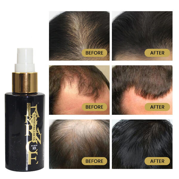 Some great things about making use of Growth of Hair Oil