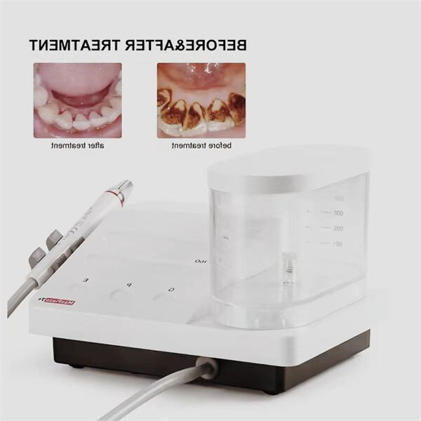 告 say goodbye to الترسبات الجيرية مع جهاز تنظيف الأسنان الكهربائي