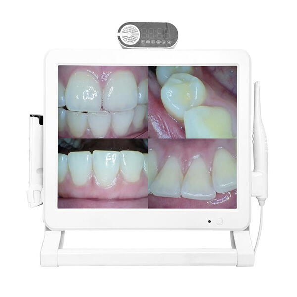 Say goodbye to traditional x-rays with a wireless intraoral camera
