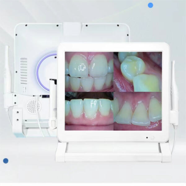 Improve your dental checkups with the advanced technology of an intra oral camera.