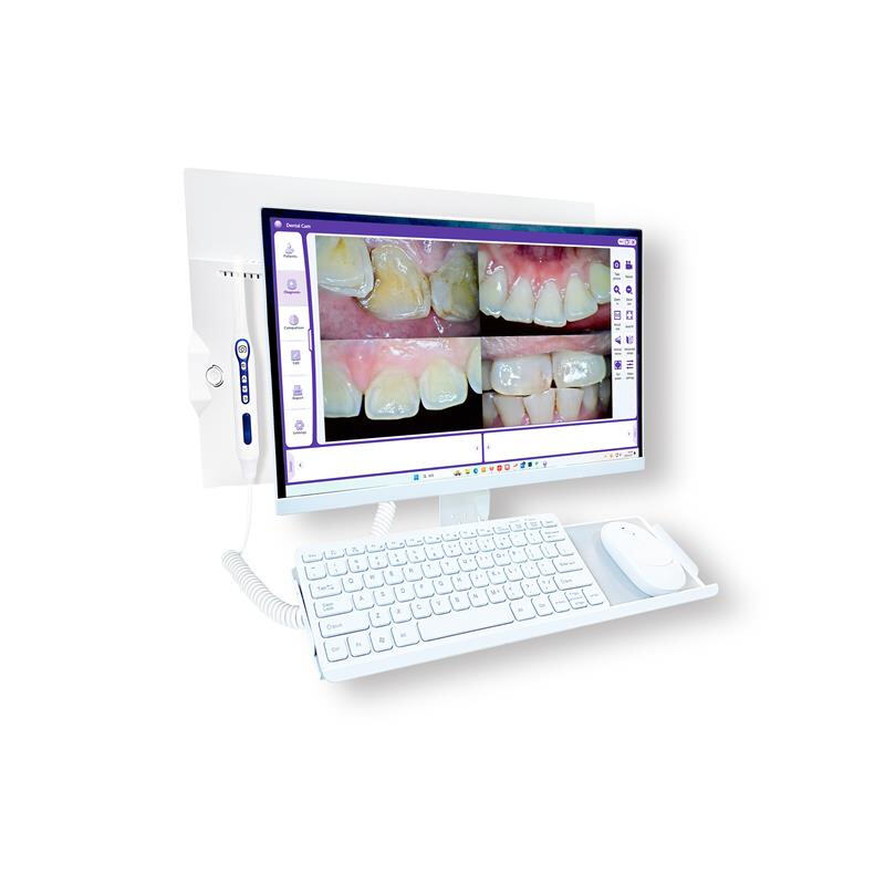 Advanced oral health management with WiFi Intraoral Camera