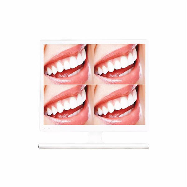 See what your dentist sees with the help of a powerful intra oral camera.