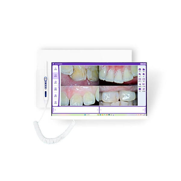 Camera Intraoral WIFI for Precise Diagnoses