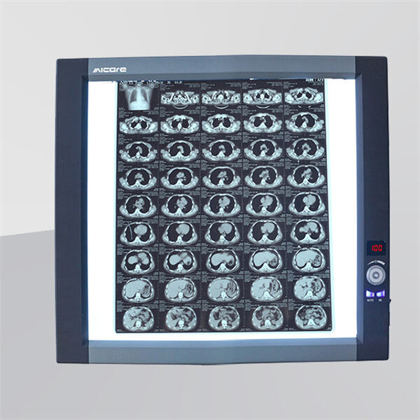 Top-Quality X-ray Film Illuminators at Wholesale Prices
