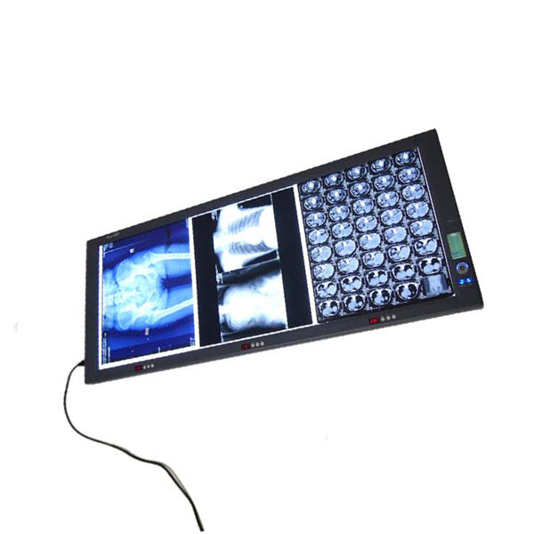 Improve Patient Care with our Reliable X-ray Film Illuminators