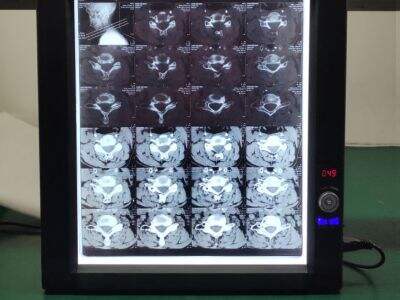 Melhores 5 Fabricantes de negatoscópio nos Emirados Árabes Unidos