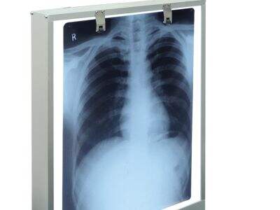 インドネシアでのX線ビューアーのトップ6卸売サプライヤー