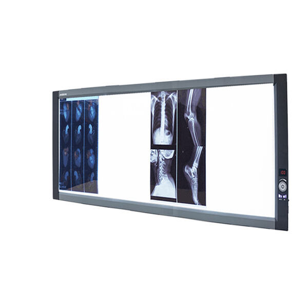 Wide selection of x ray film readers to meet all needs