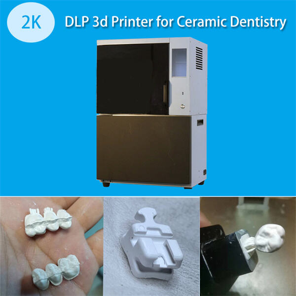 Comment l'impression 3D métallique transforme l'avenir de la dentisterie