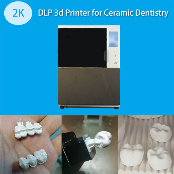 Optimizacija radnih procesa u dentalnim laboratorijumima sa 3D štampanjem