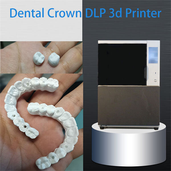 Aprimorando a Precisão e Eficiência Dentária