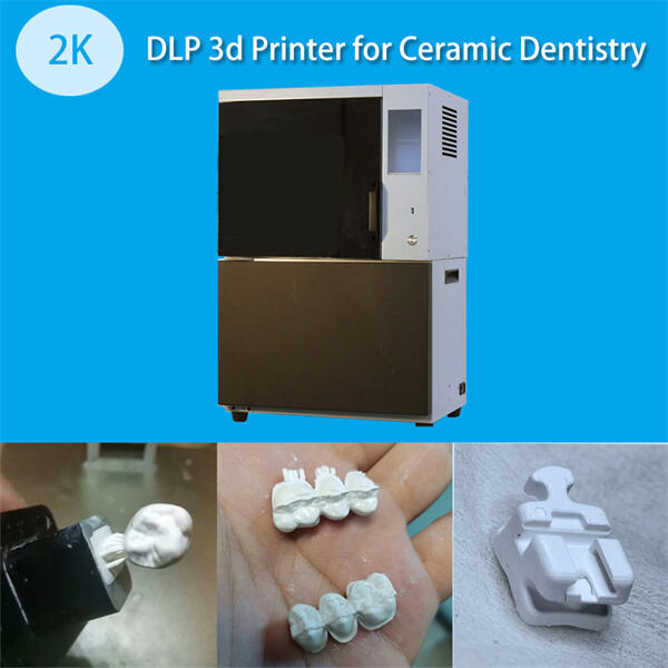 Creating Custom Dental Implants with 3D Printing Technology