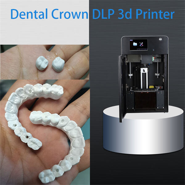 Przewagi druku 3D żywicą stomatologiczną