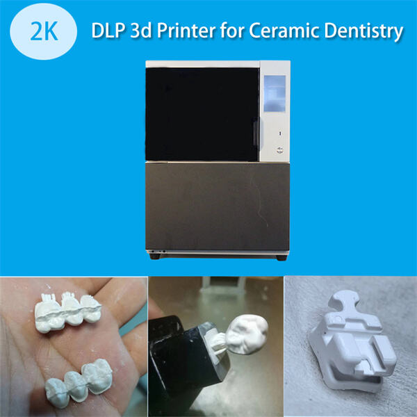 Les avantages de l'utilisation d'une imprimante 3D métallique dentaire pour les couronnes et ponts