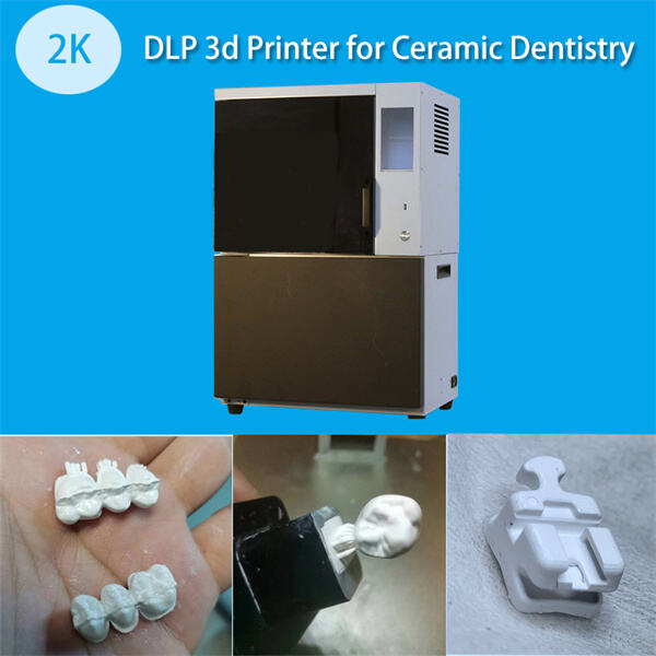 Conception d'implants dentaires avec des solutions d'impression 3D métallique sur mesure