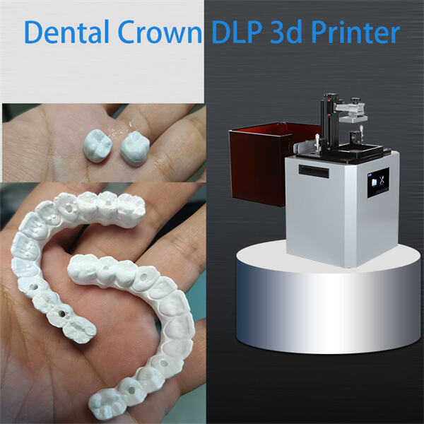 Postizanje savršenih dentalnih utisaka s 3D rezinama