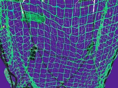 Gabion Tuber vs. Gabion Net: Hovedskillinger og Anvendelser
