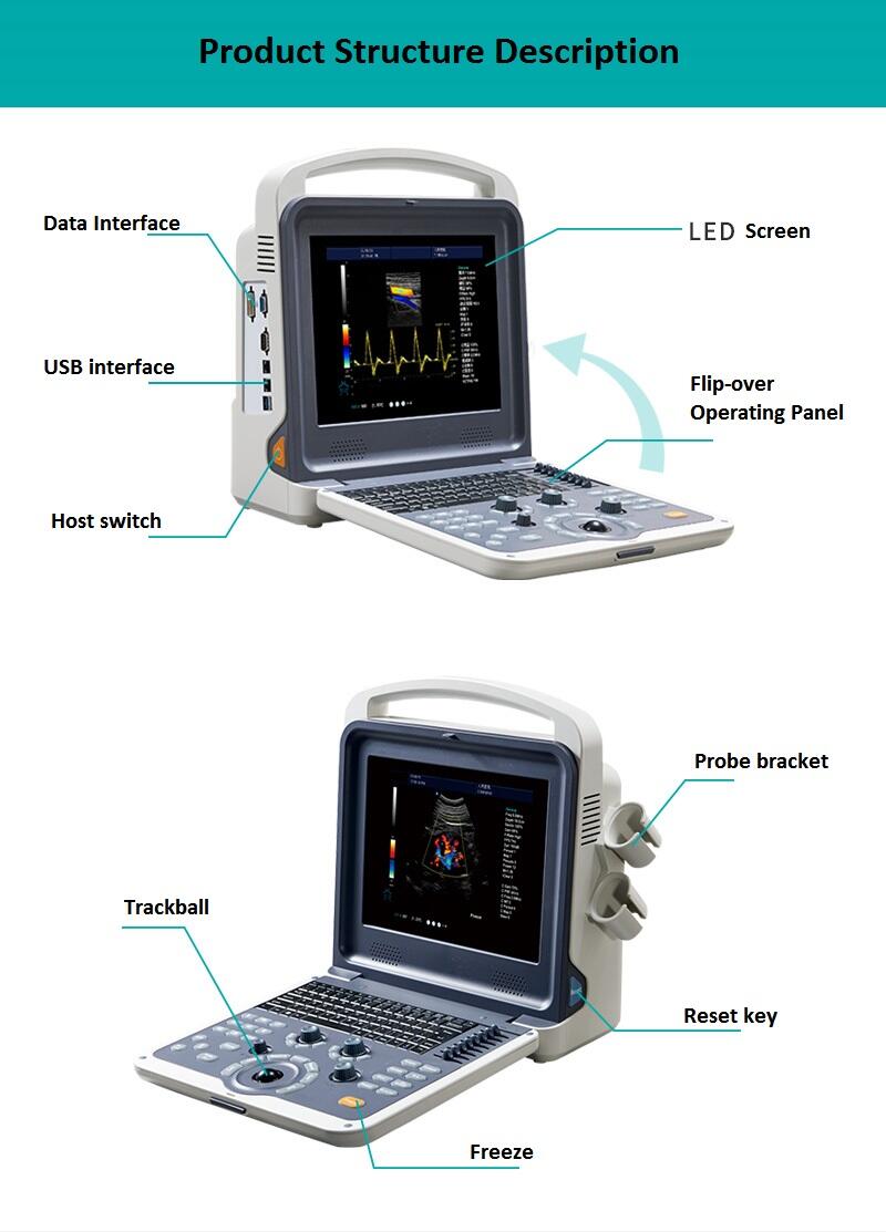 Doppler Ultrasound YJ-U60PLUS manufacture