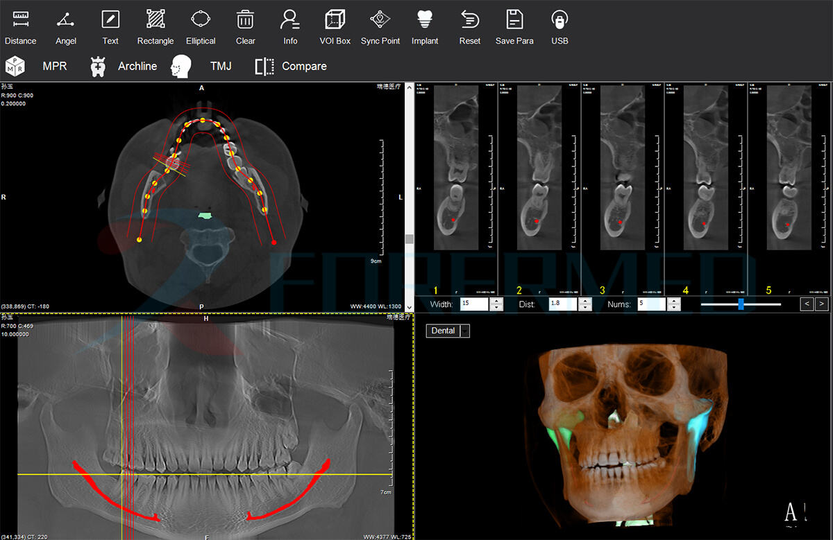 Panoramic Dental X-ray  manufacture