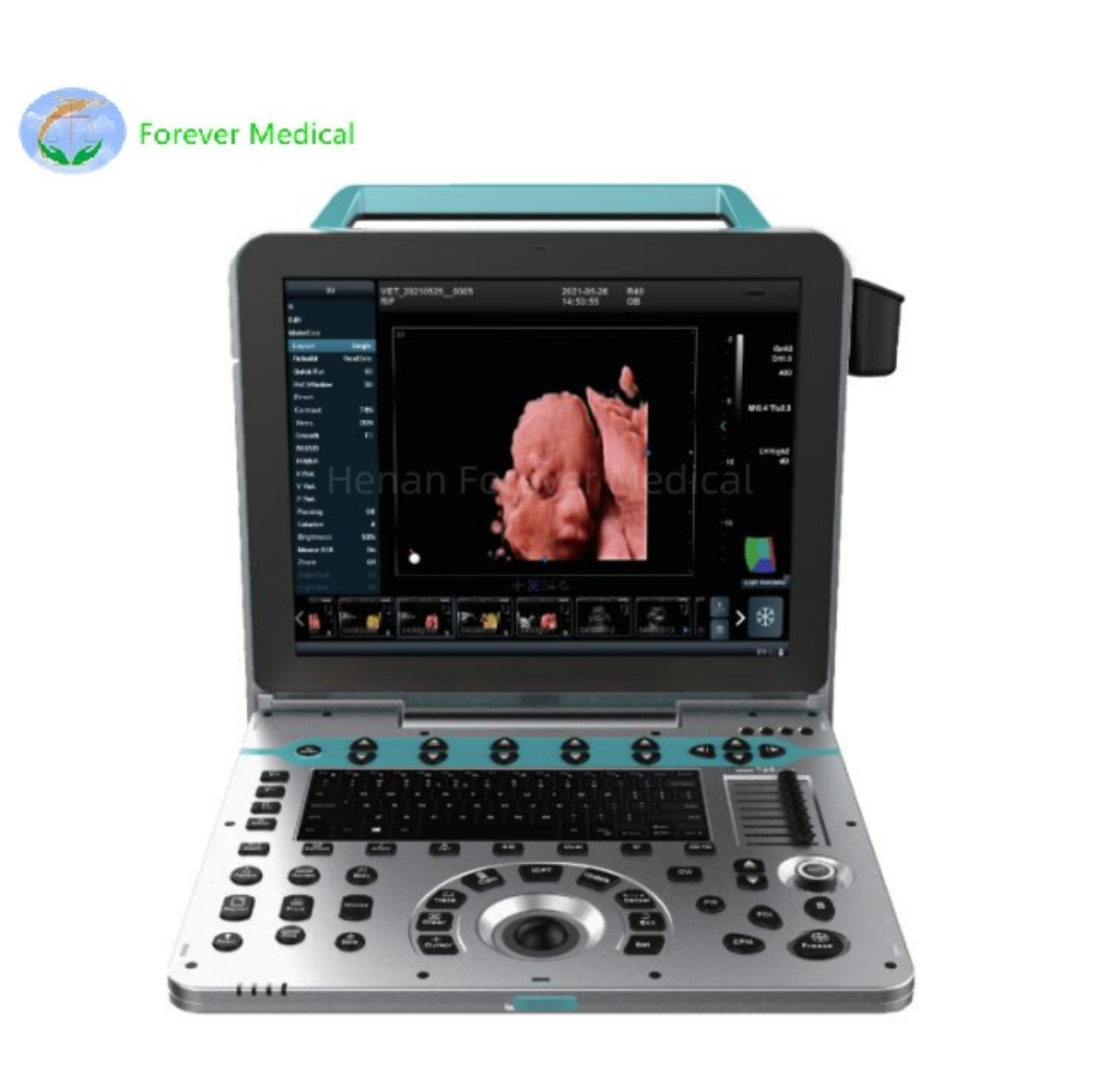 Exploring the World of 5D Ultrasound