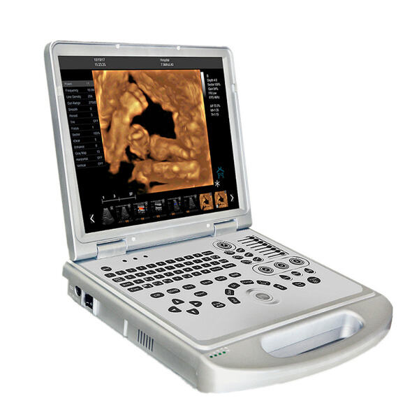 Berdayakan Latihan Anda dengan Dijual Mesin Ultrasound Portabel