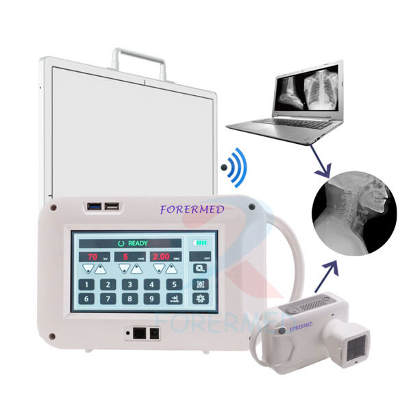 ស្វែងរកឧបករណ៍ X-ray ចល័តស្រាលបំផុត និងមានប្រសិទ្ធភាពបំផុតនៅលើទីផ្សារ